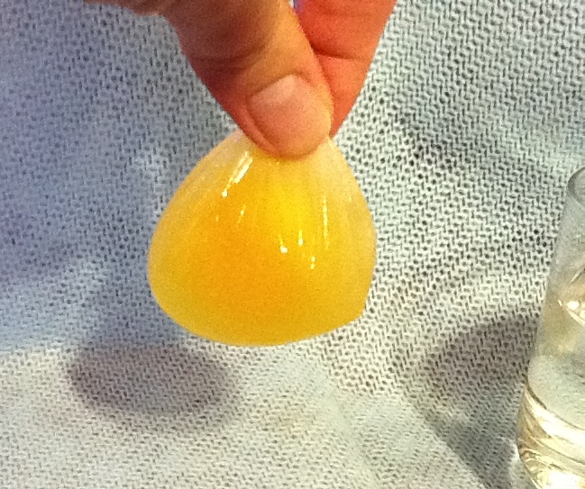 Daily Messes Egg Experiment (The Shellless Egg!)